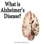 Alzheimer’s Dementia and related diseases – Copy